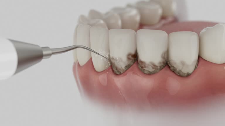Reliable Dental Implants contractor in Bannockburn, IL by Smile Center Dentistry